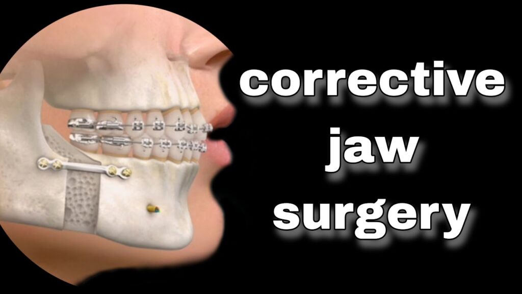 The Link Between Jaw Structure and Chronic Facial Pain